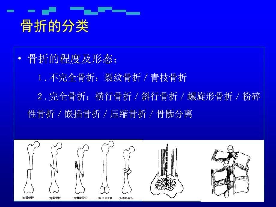 骨骼损伤概论_第5页