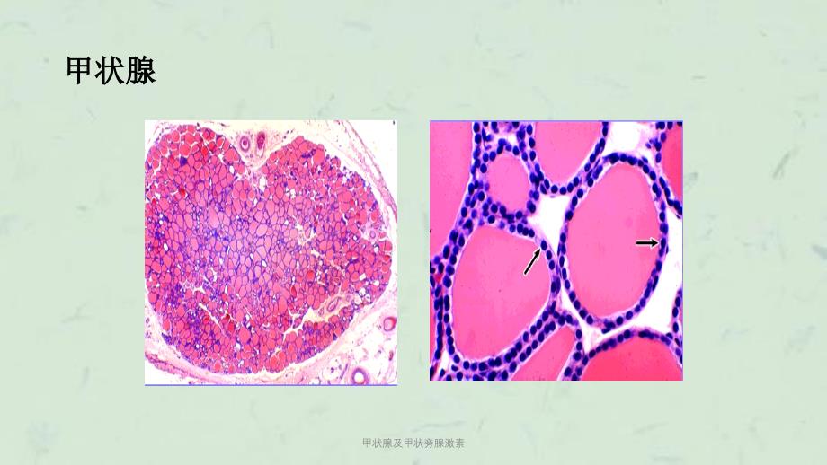 甲状腺及甲状旁腺激素课件_第3页