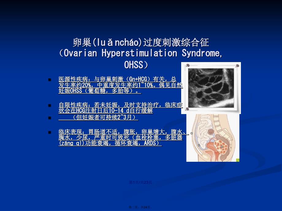 OHSS综合诊治学习教案_第2页