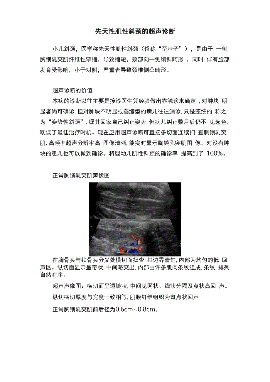 先天性肌性斜颈的超声诊断_第1页