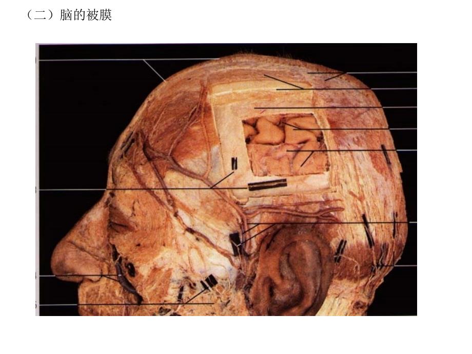 《基础解剖学》课件：22脑脊膜_第3页