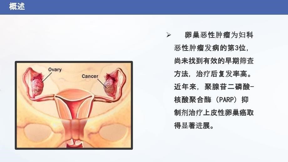 卵巢肿瘤诊治_第5页