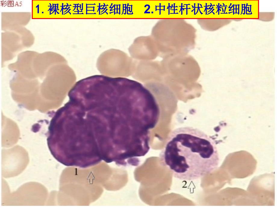 骨髓细胞图谱_第3页