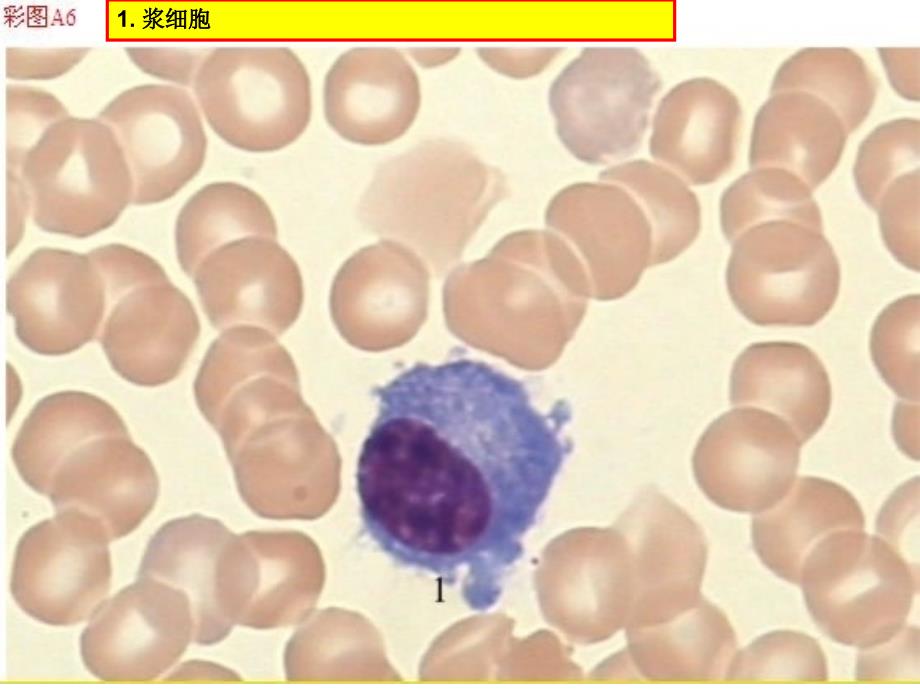 骨髓细胞图谱_第4页