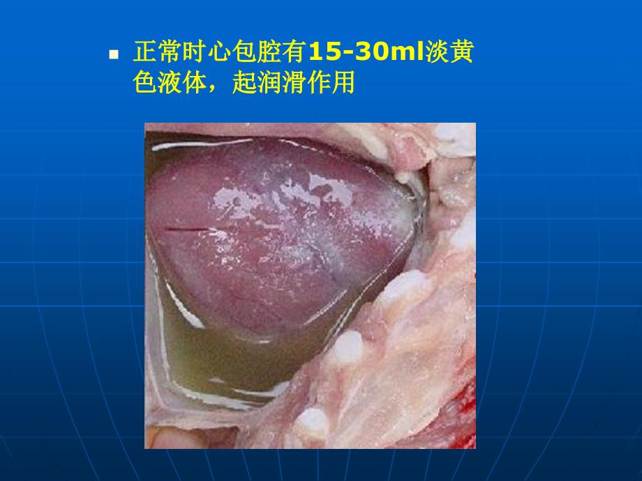 【精品】心包积液_第3页