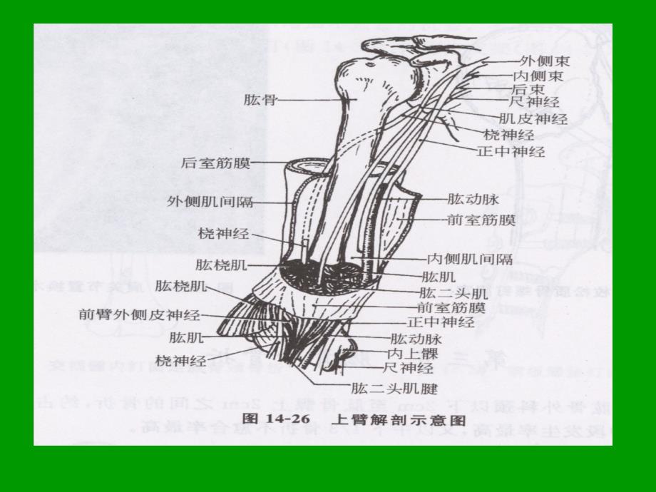 肱骨骨折护理查房ppt课件_第3页