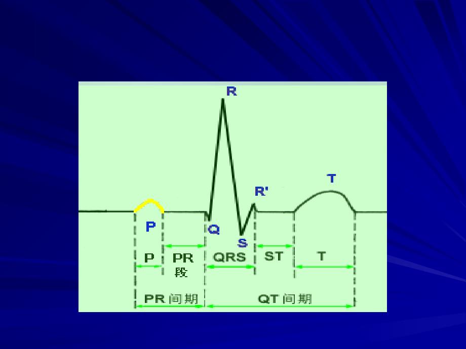 最新常见心电图的诊断PPT文档_第4页