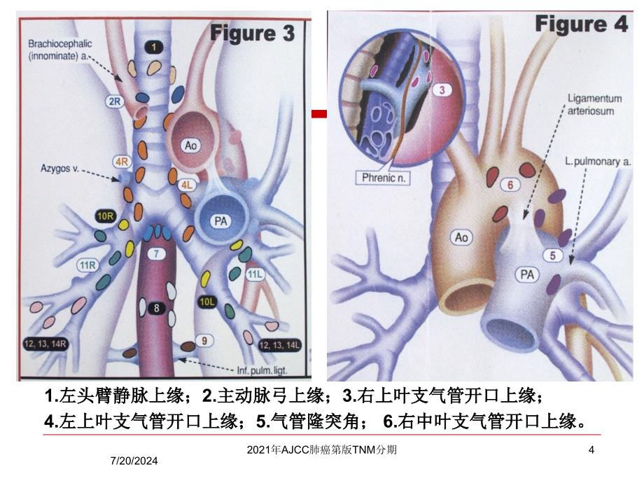 2021年AJCC肺癌第版TNM分期课件_第4页