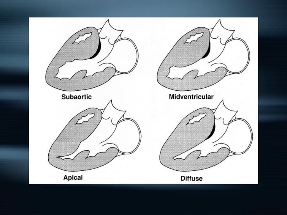 第八章心肌病二_第5页