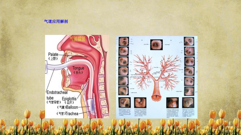 人工气道护理精选干货_第2页