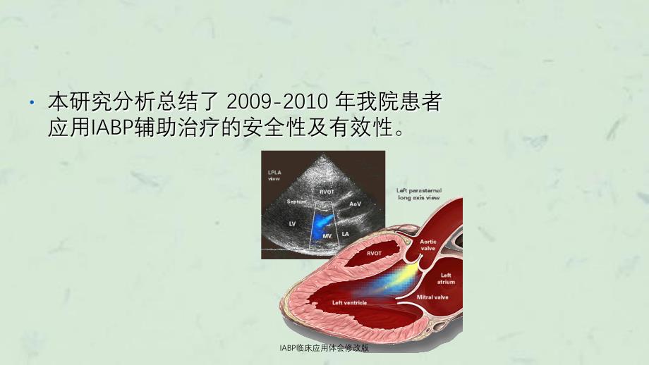 IABP临床应用体会修改版课件_第4页