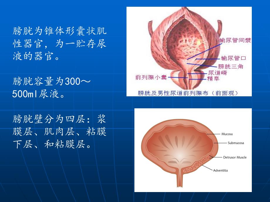 膀胱癌术后护理查房ppt课件.ppt_第2页