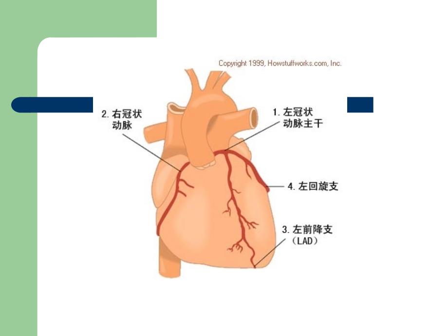 心绞痛的典型心电图表现_第3页