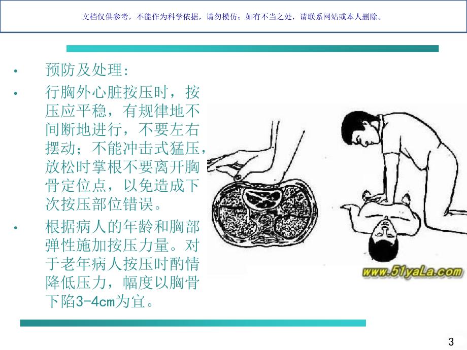 胸外心脏按压操作并发症和处置课件_第3页