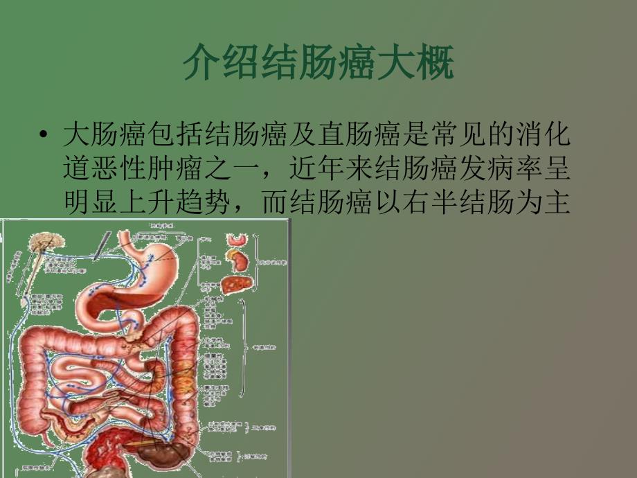 结肠癌教学查房_第3页