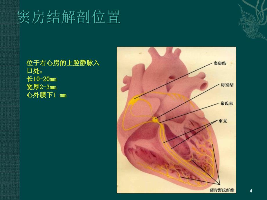 病态窦房结综合征ppt演示课件_第4页