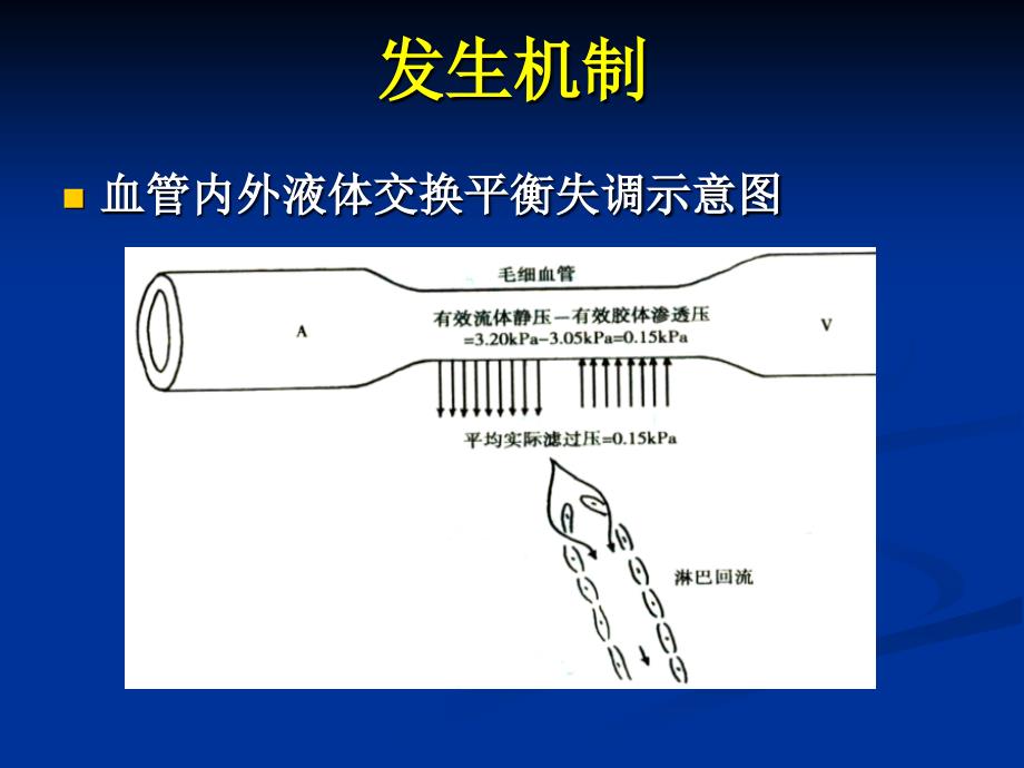 水肿的一般概念_第3页