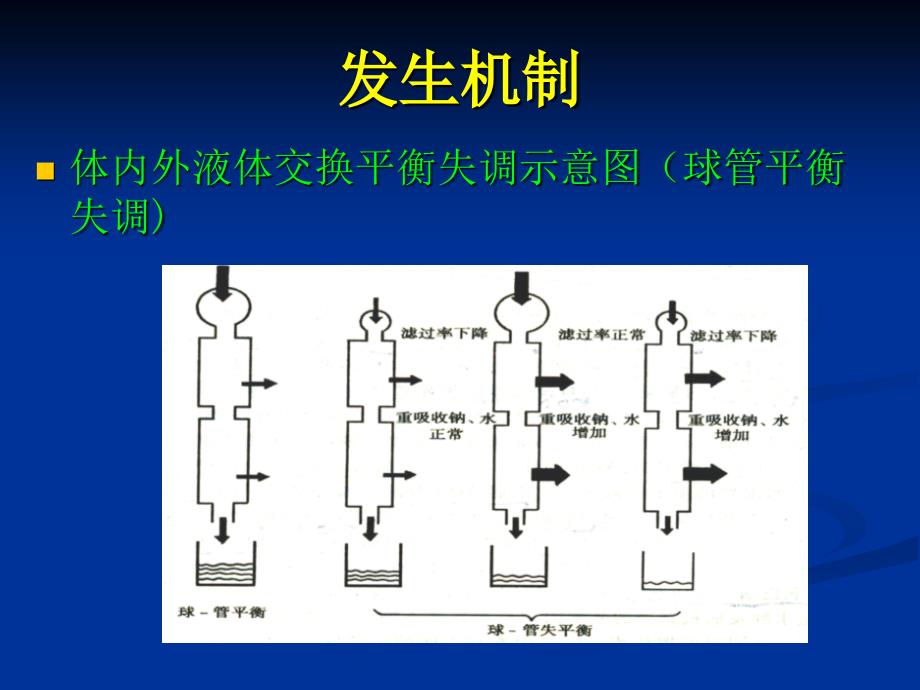 水肿的一般概念_第4页