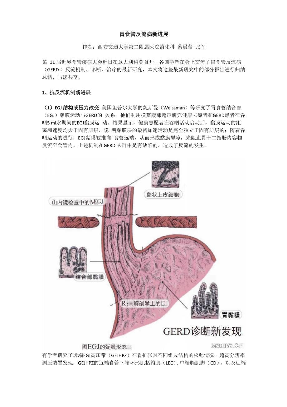 胃食管反流病新进展_第1页