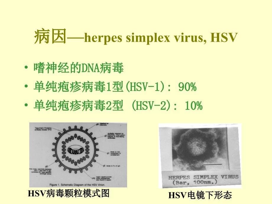 《中枢神经系统感染》PPT课件_第5页