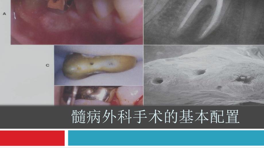 根尖手术的器械准备课件_第1页