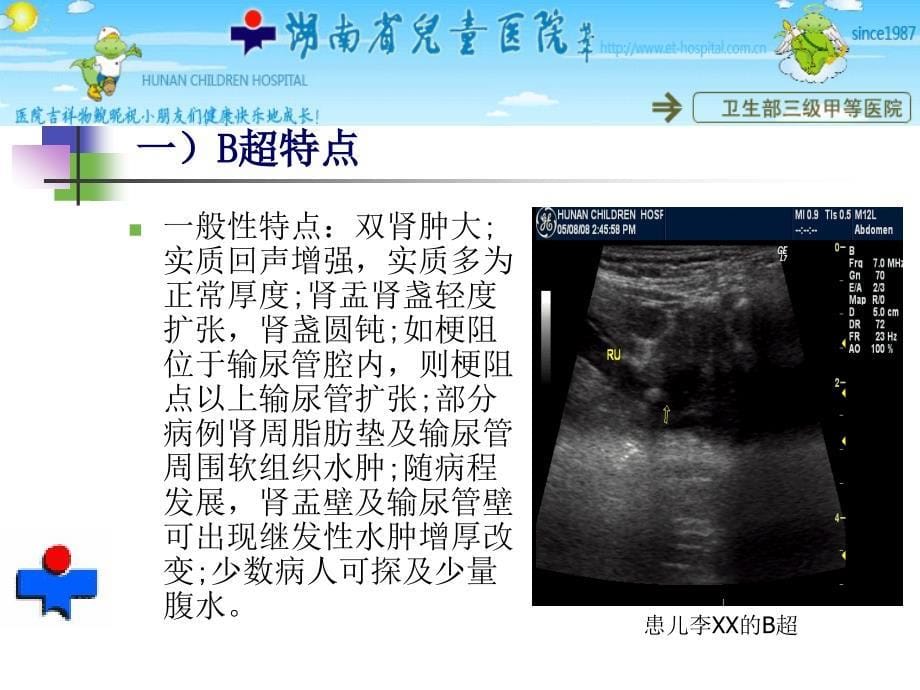 与食用受污染三鹿牌婴幼儿配方奶粉相关的婴幼儿泌尿_第5页