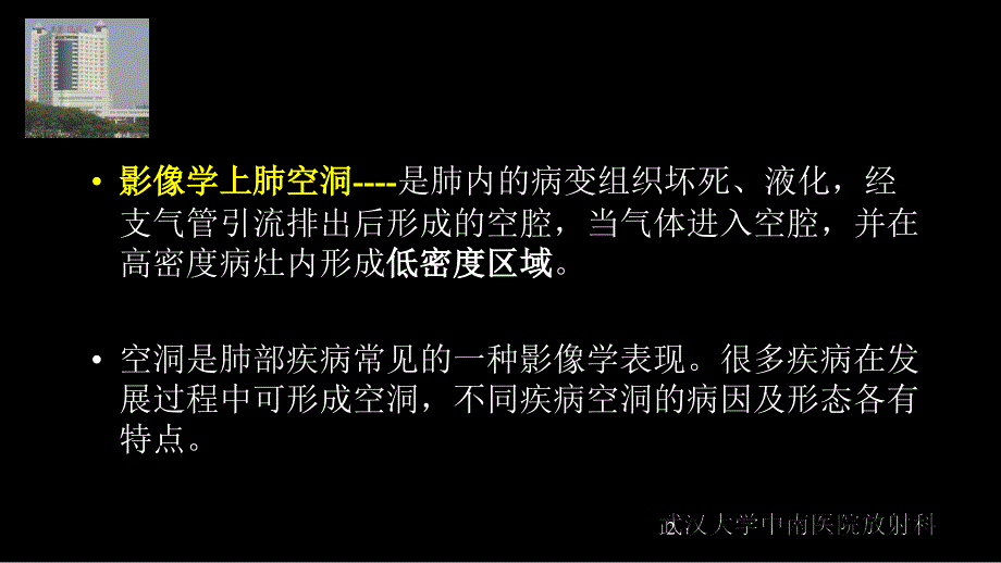 空洞病变的诊断与鉴别诊断_第2页