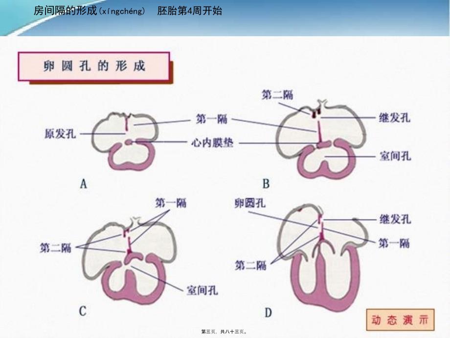 医学专题—儿童先天性心脏病7671_第3页