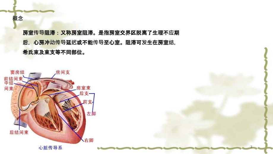 三度房室传导阻滞护理查房实用课件_第3页