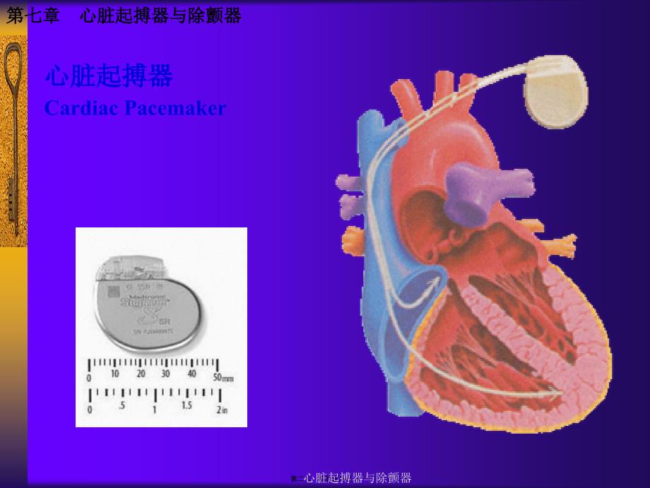 心脏起搏器与除颤器课件_第2页