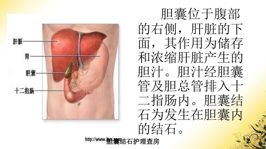 胆囊结石护理查房培训课件_第2页