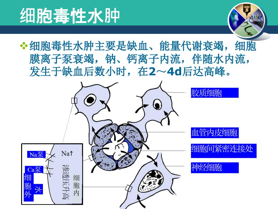 颅内高压与脑水肿的机制及治疗 PPT课件.ppt_第4页