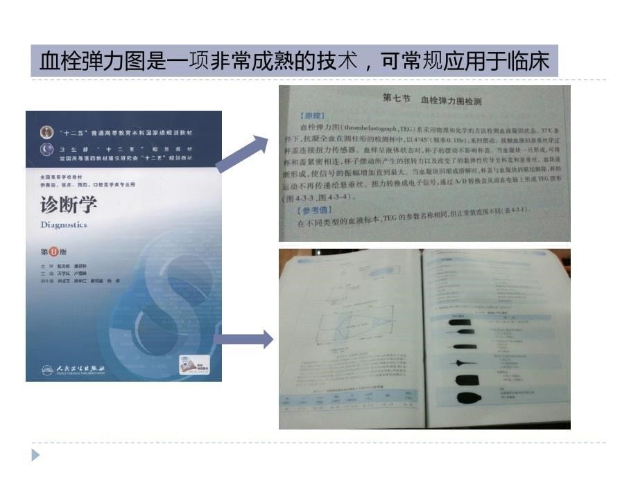 血栓弹力图的临床应用医院全.ppt_第5页