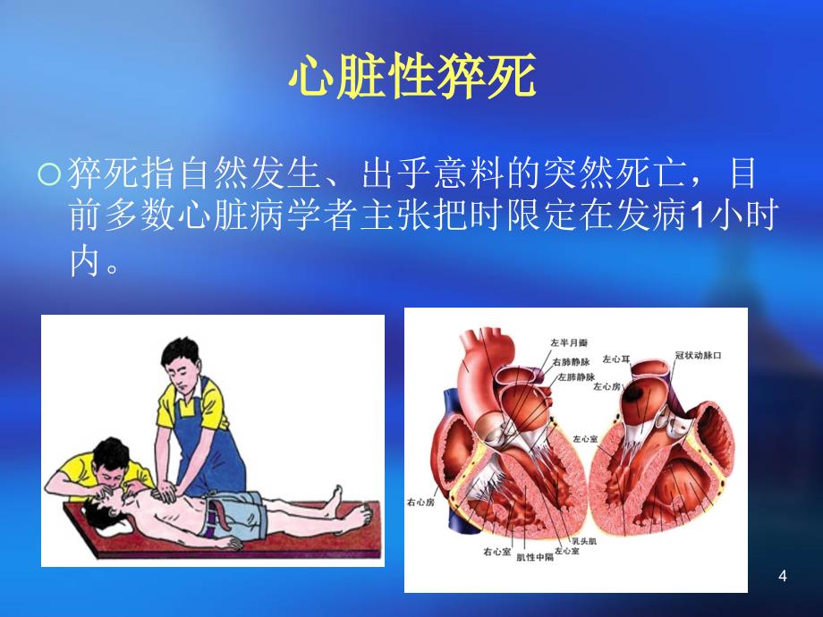 医院常见内科急重症的诊断与案例_第4页