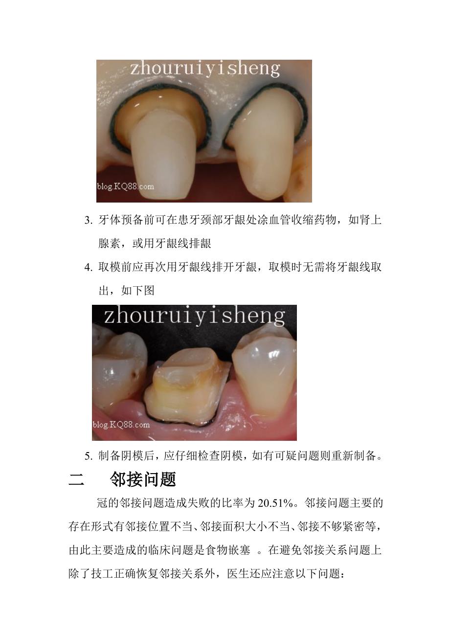 冠桥修复失败原因分析.doc_第3页