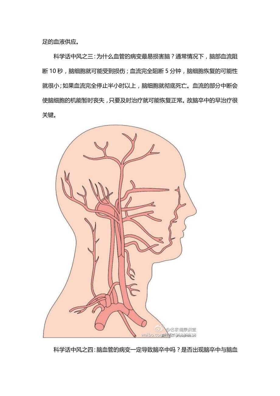 科学话中风doc.doc_第2页