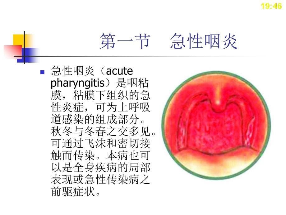 耳鼻喉科常见疾病PPT课件_第5页