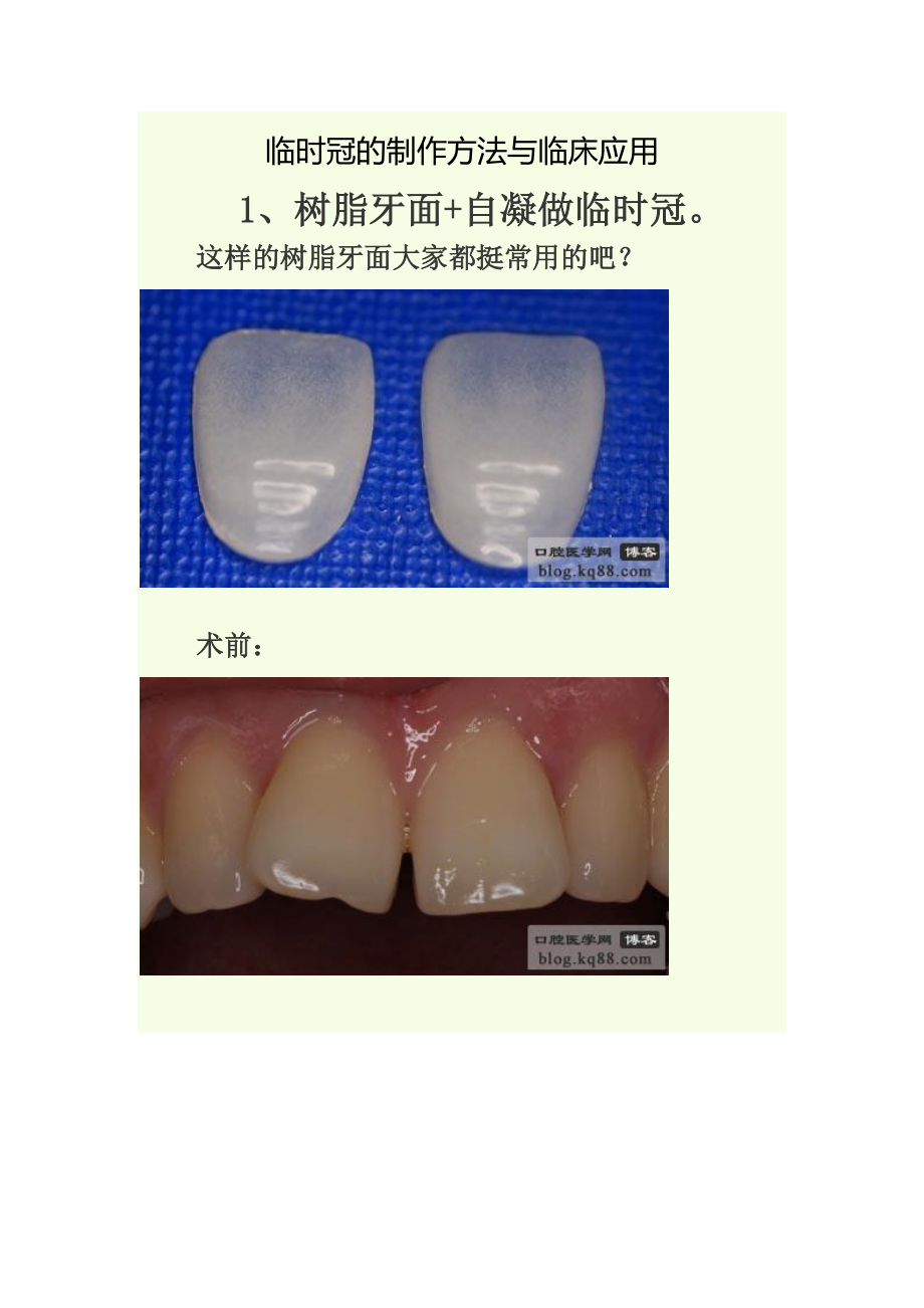 临时冠的制作方法与临床应用_第1页