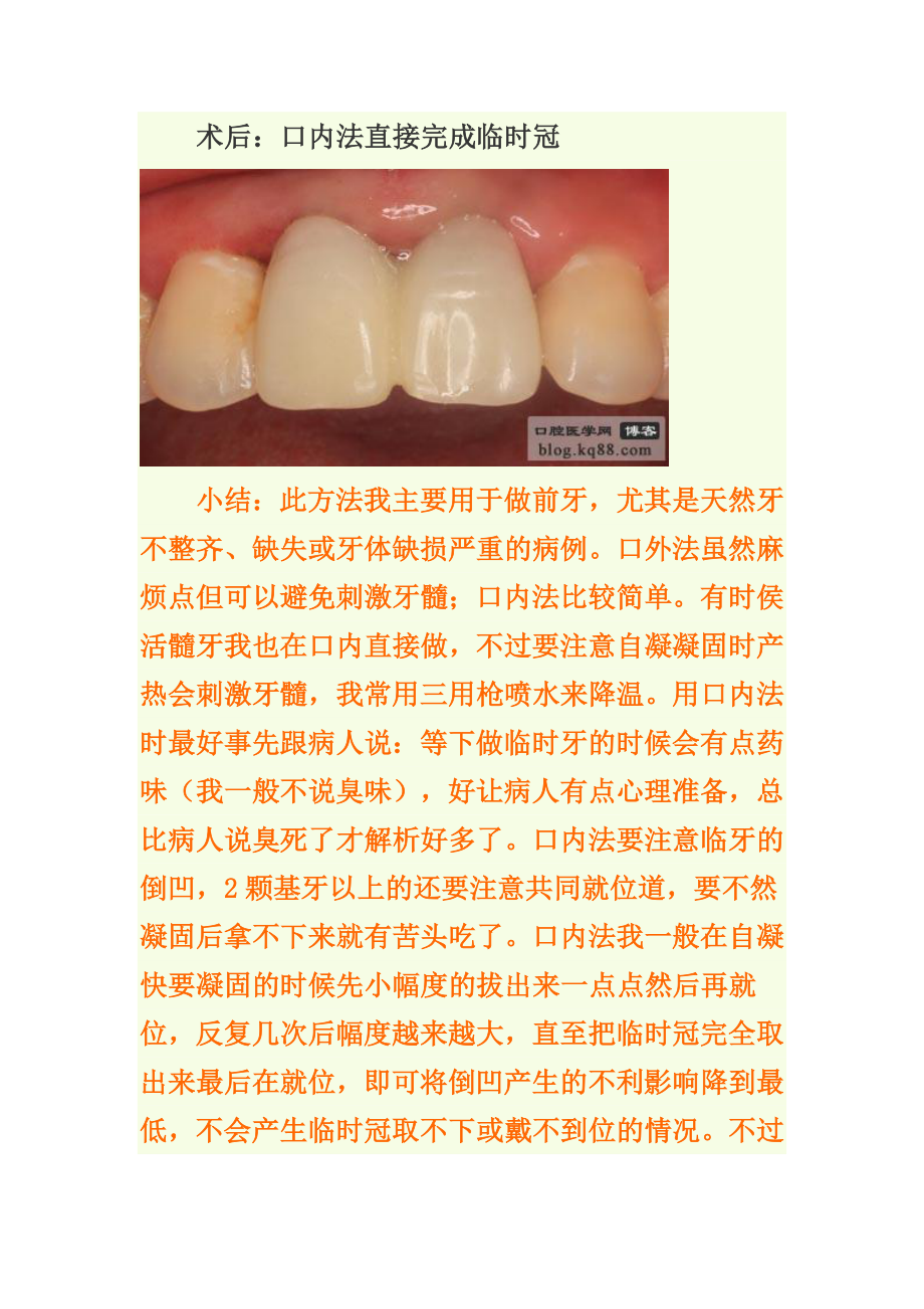 临时冠的制作方法与临床应用_第3页