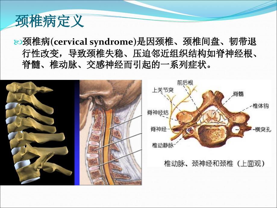 颈椎病的治疗与康复PPT课件_第2页