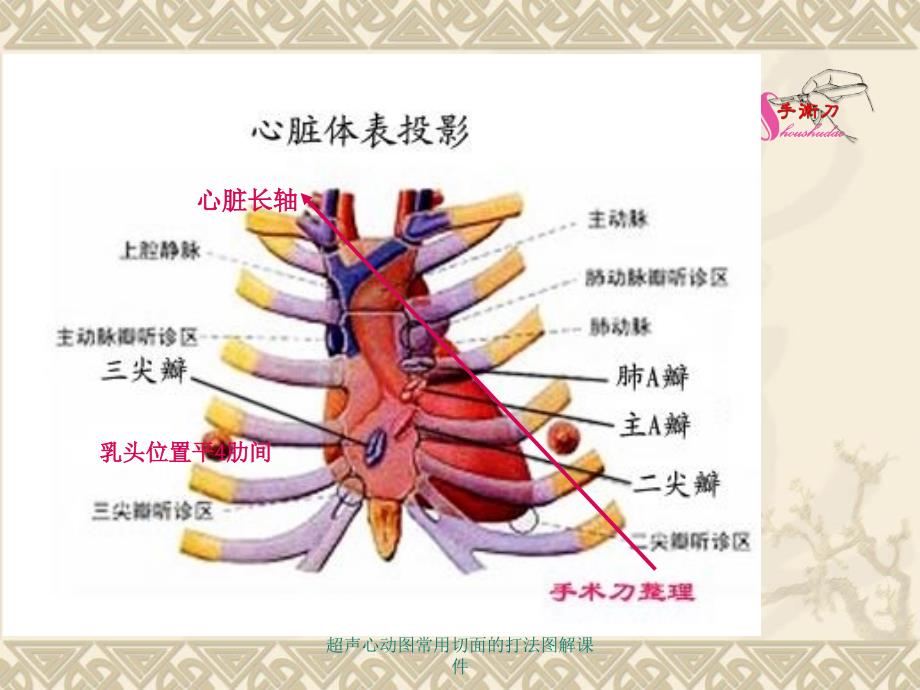 超声心动图常用切面的打法图解课件_第3页