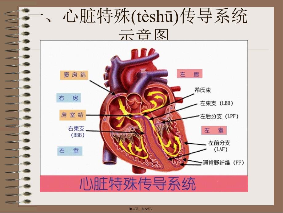 临床常见心电图分析复习进程_第2页