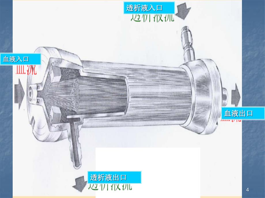 常见透析器介绍精选PPT_第4页