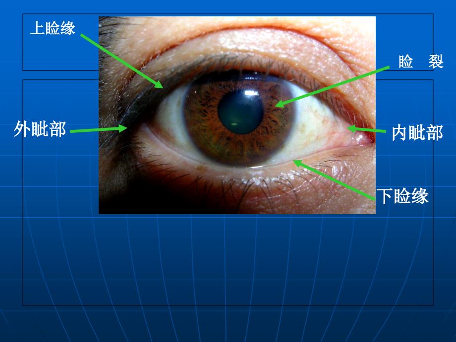 第三章 眼睑病病人的护理图文_第4页