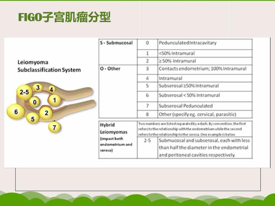 医学专题：妊娠合并子宫肌瘤的处理_第4页