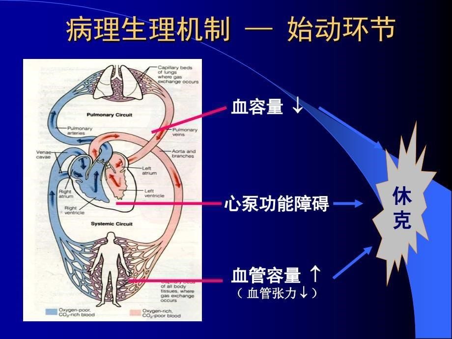 医学心源性休克专业知识讲座培训课件_第5页