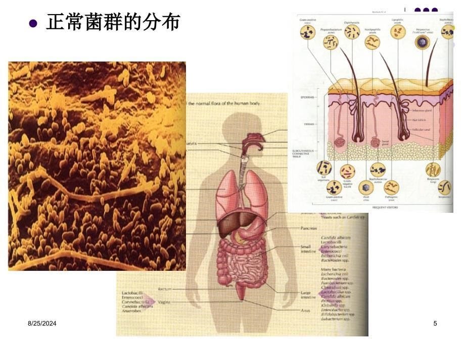 微生物感染与致病机制.ppt_第5页