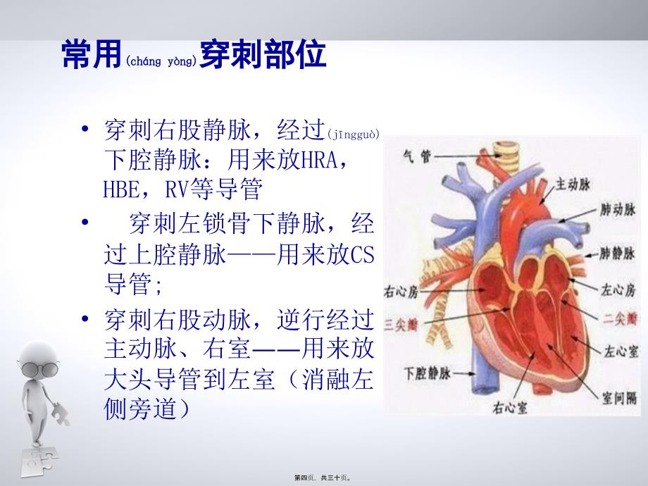 心脏射频消融术课件_第4页