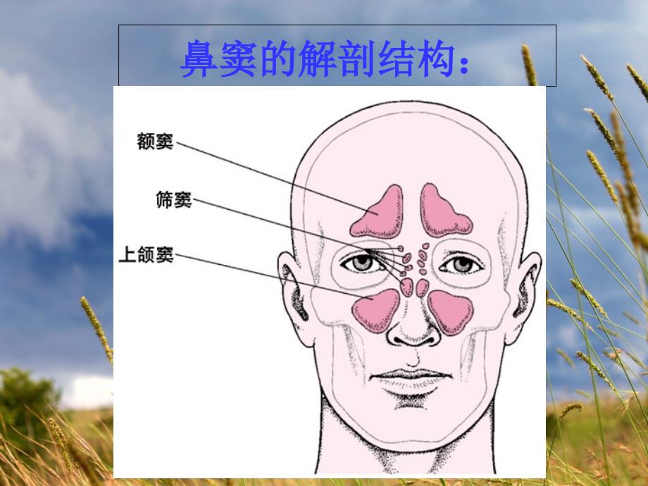 鼻窦炎的分类及护理_第4页