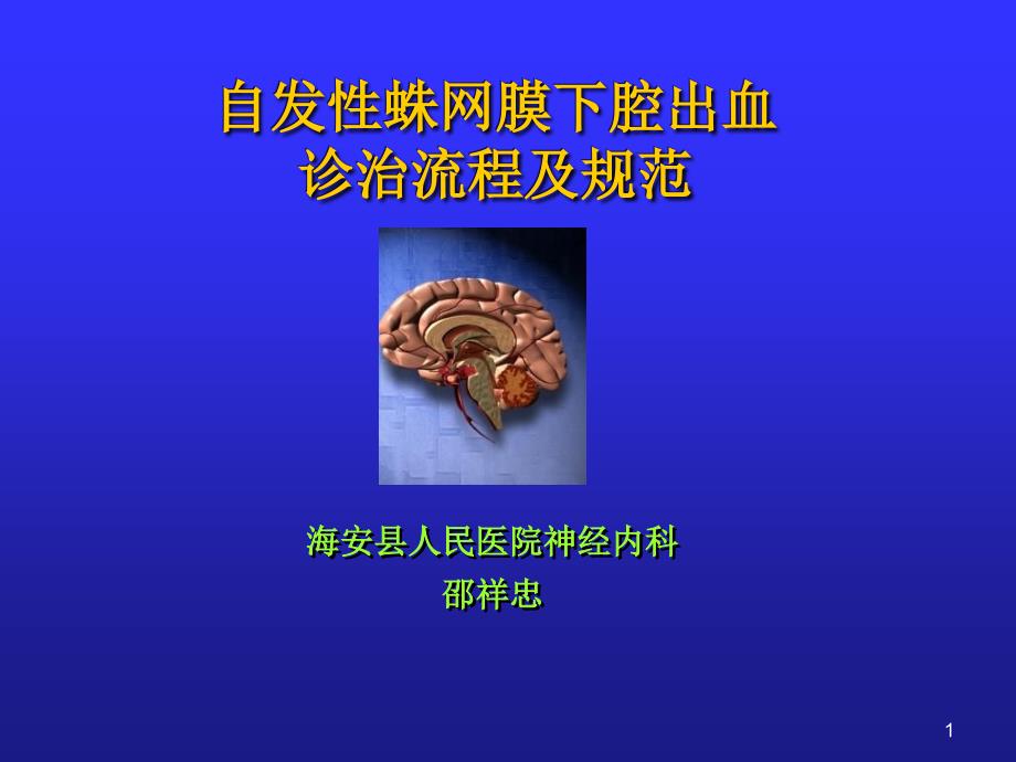 自发性蛛网膜下腔出血诊治流程及规范_第1页